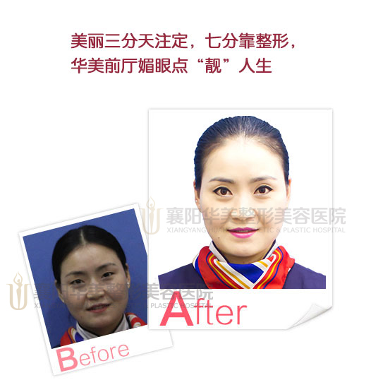 【襄阳华美我代言】华美员工邀您共同见证华美安全塑美