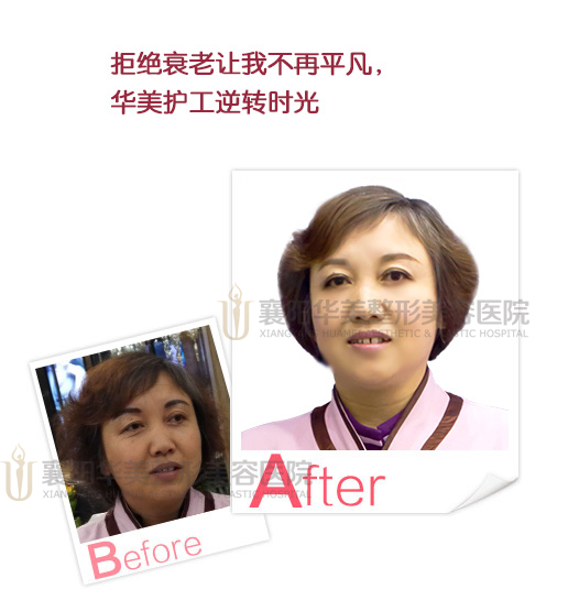 【襄阳华美我代言】华美员工邀您共同见证华美安全塑美